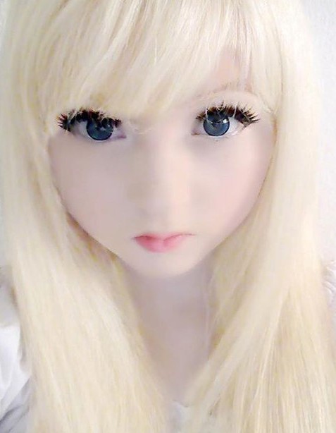 白化病蘿莉照片