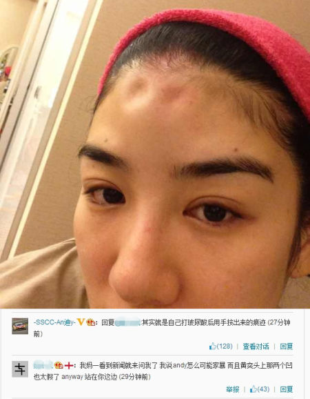 黃奕曬家暴照片