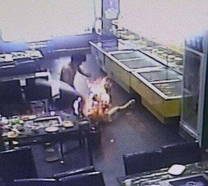 女大學生吃燒烤80%燒傷