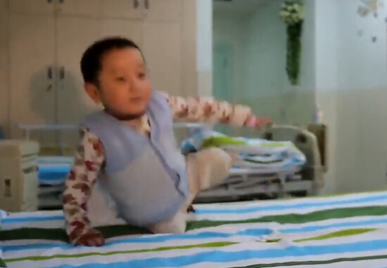 四歲截肢小男孩跳小蘋果