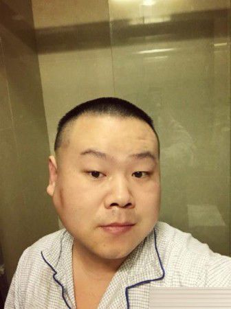 岳云鵬腫瘤手術(shù)成功