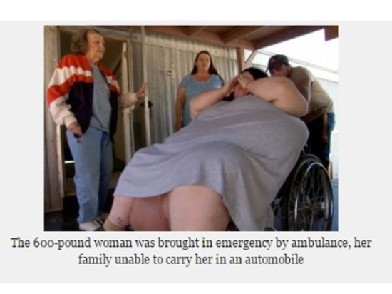 體重272公斤的女子產下18公斤巨嬰