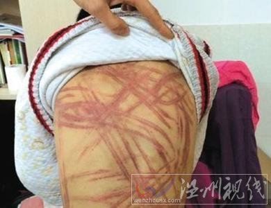 南京虐童案最新報道