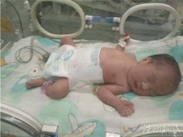90后誕下四胞胎的概率超級小