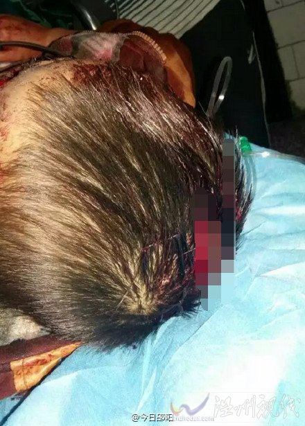 10.11湖南邵陽惡性虐童案最新消息