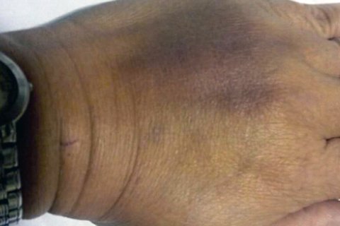 業主被跟蹤毆打