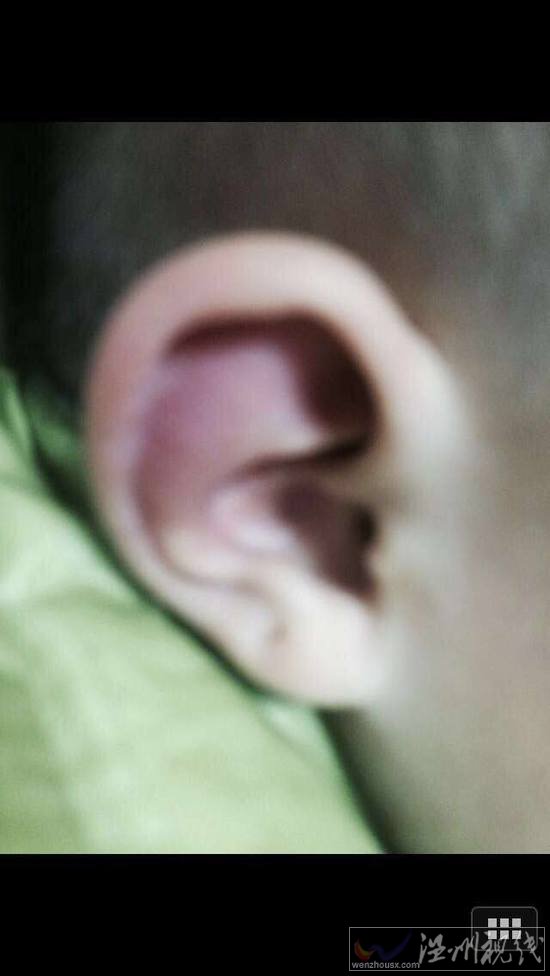 青島幼兒園虐童 老師虐打小朋友