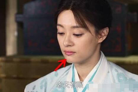 孫儷唇痣車禍造成