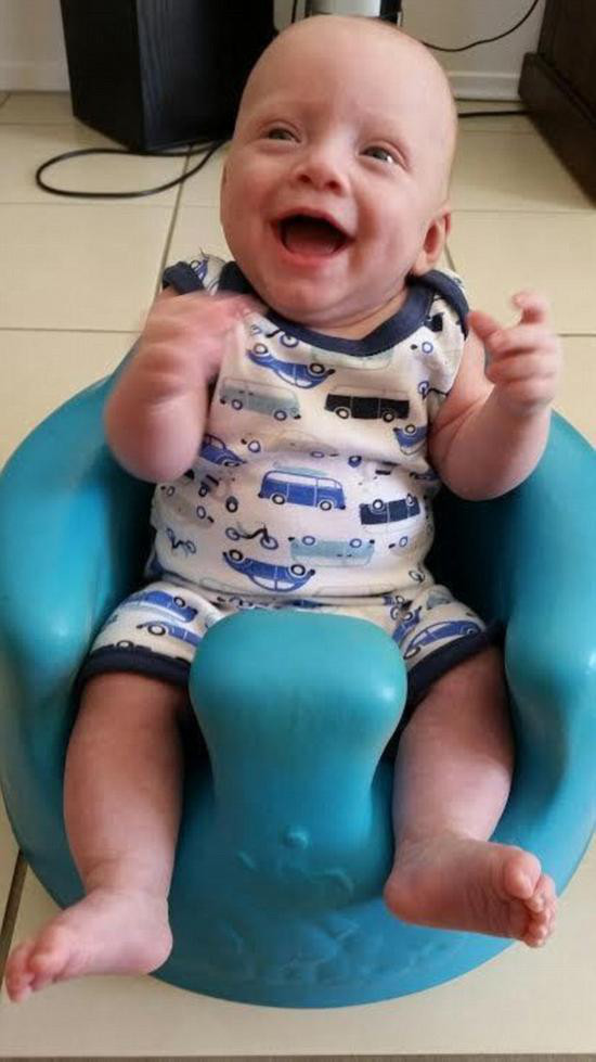 胎兒腹裂奇跡存活