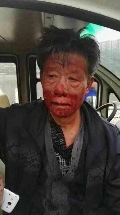 兩女遛狗圍攻老人