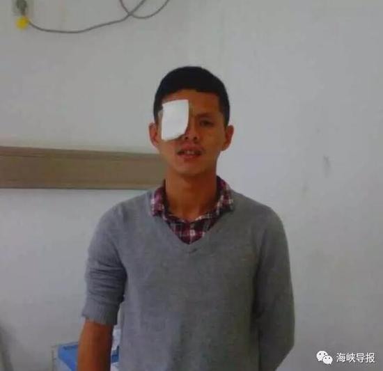 小伙吃燒烤后眼瞎