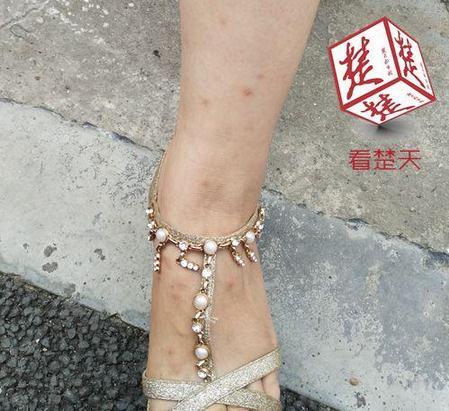 武漢小區跳蚤肆虐