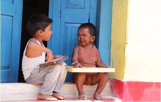 男子5歲停止生長