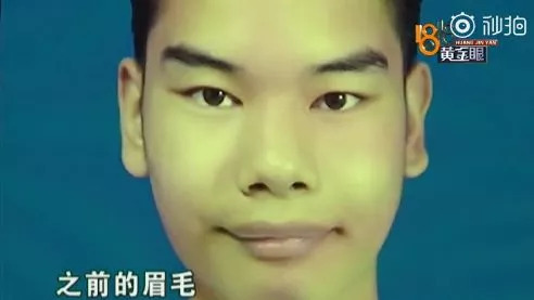 發(fā)際線男孩走紅