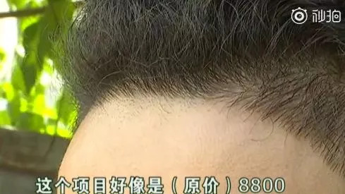 發(fā)際線男孩走紅