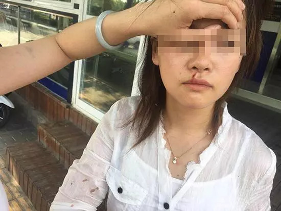 滴滴司機打傷乘客 女乘客吐口水惹事