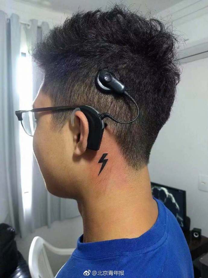 男子丟20萬元耳蝸