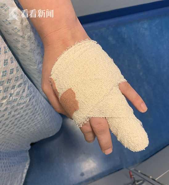 孕婦做美甲遭感染