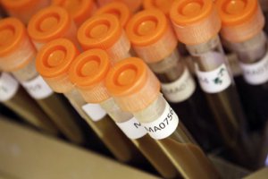 濫用抗生素導(dǎo)致細(xì)菌產(chǎn)生耐藥性