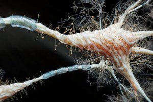 科學(xué)家發(fā)現(xiàn)治療帕金